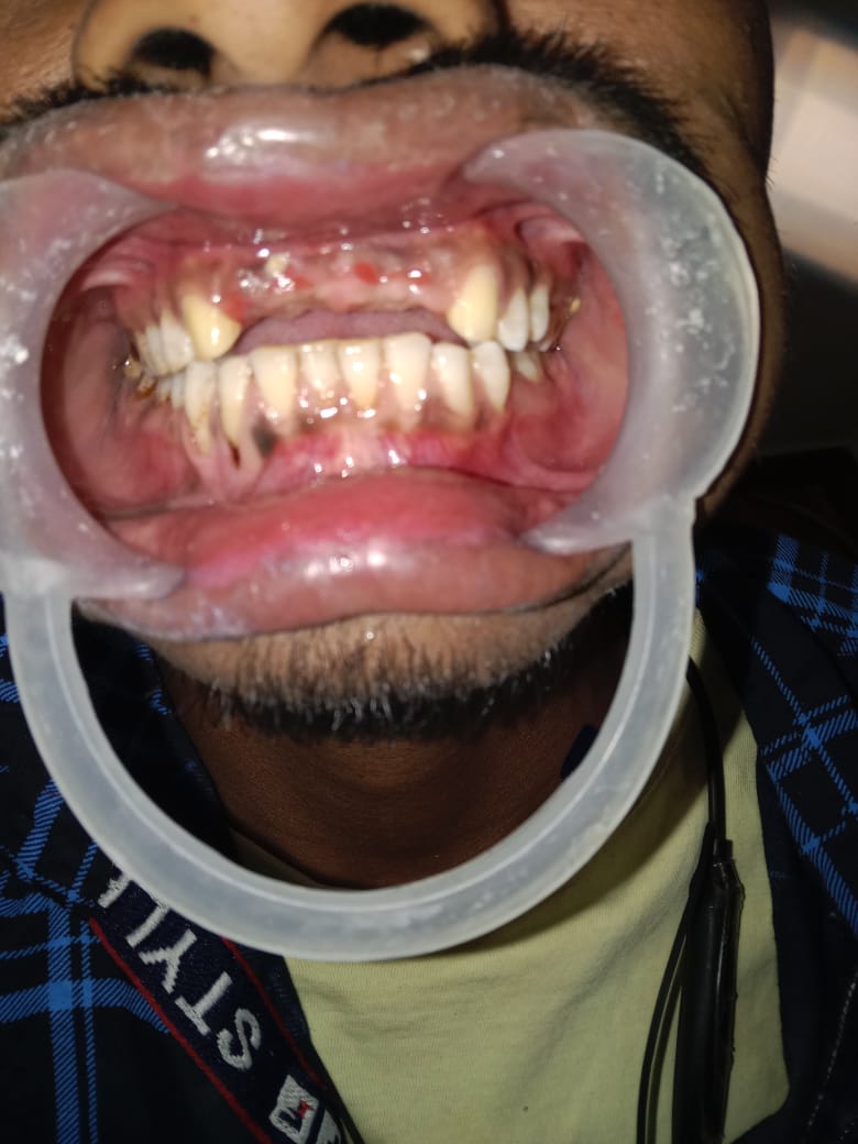 After